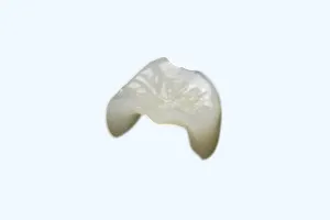 CAD/CAMインレーの画像