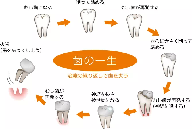 歯の一生の画像