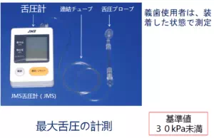 舌圧の画像