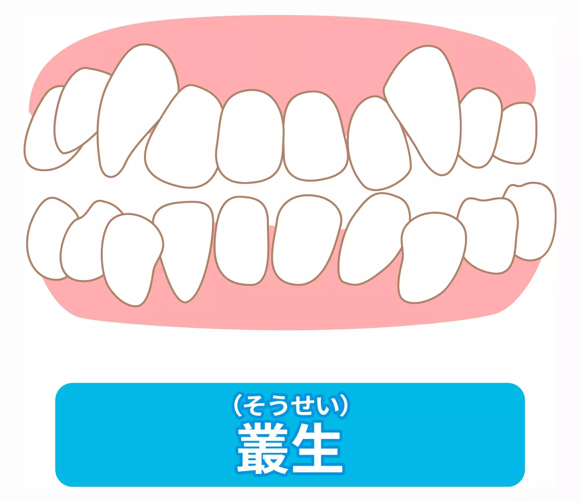 叢生の画像
