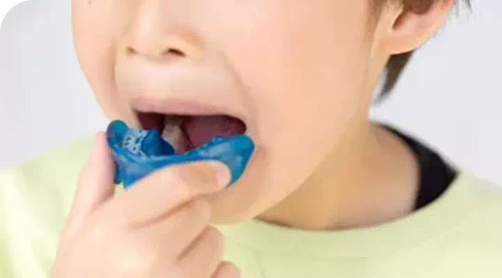 小児矯正のイメージ画像