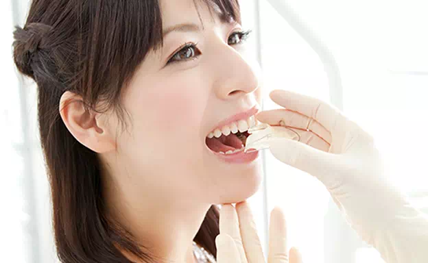 マウスピースを付ける患者さんの画像
