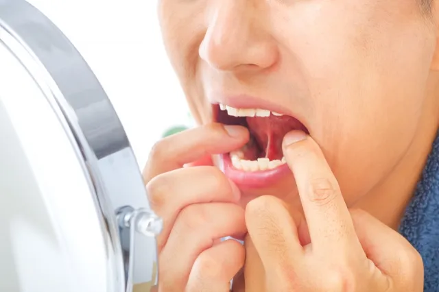 十日市場ファミリー歯科の歯周病治療