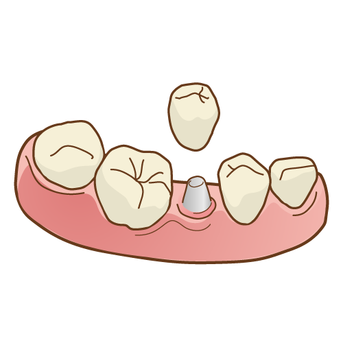 ブログの画像