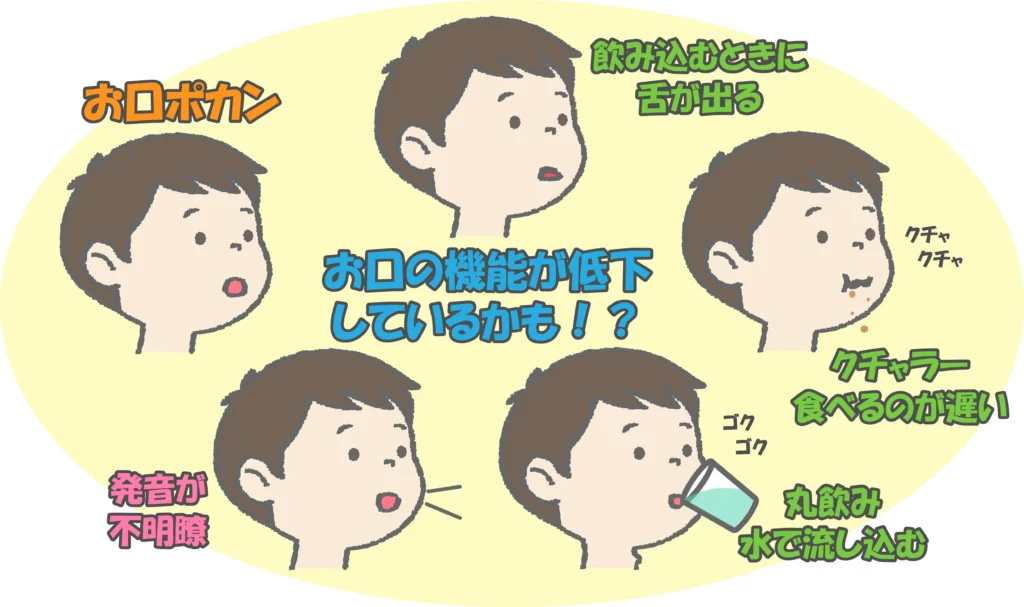 お口ポカンリスク